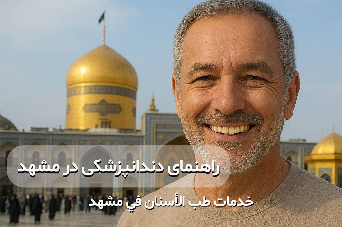 راهنمای کامل ایمپلنت و لمینت در مشهد؛ مخصوص مشهدیها و عربزبانها طب الأسنان فی مشهد